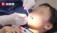 10岁娃用牙洞修复牙膏后损失6颗牙,用牙膏就可以补牙洞？
