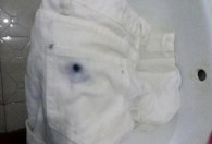 白色牛仔裤上的污渍怎么去除 白色牛仔裤上的污渍如何去除